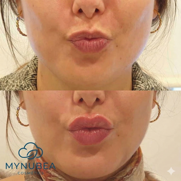 Resultado de Sonia. 45